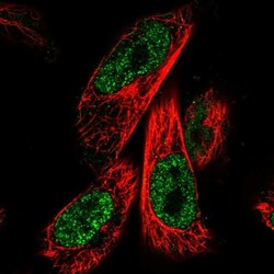 ZNF480 Antibody, Novus Biologicals 0.1mL; Unlabeled:Antibodies, Polyclonal